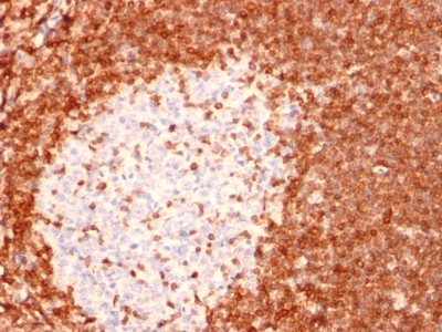 Formalin-fixed, paraffin embedded human tonsil sections stained with 100 ul anti-Bcl-2 (clone 8C8) at 1:300. HIER epitope retrieval prior to staining was performed in 10mM Tris 1mM EDTA, pH 9.0.
